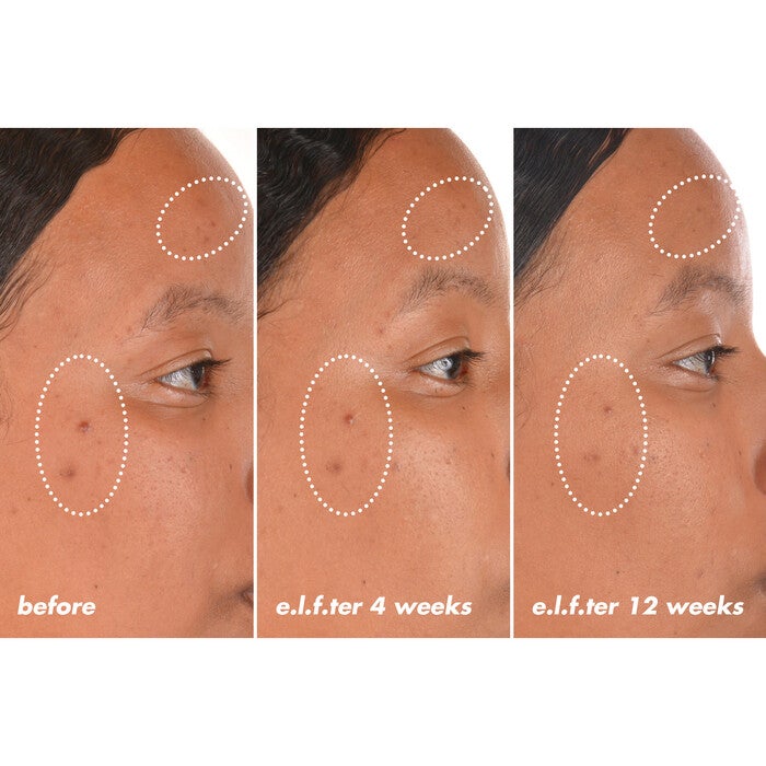 Before and After Results After Using Vitamin C +E + Ferulic Brightening Face Serum